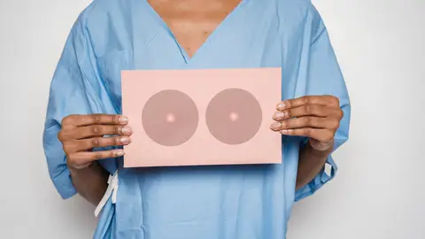 Cáncer de mama Cáncer de mama