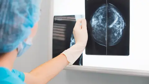 Mamografía Mamografía