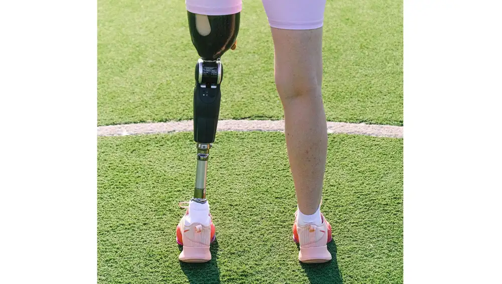 Mujer con prótesis de pierna