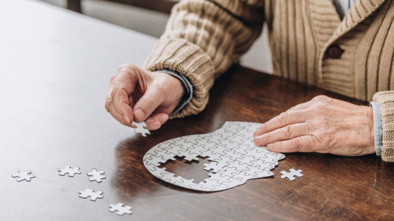 La IA supera las pruebas clínicas al predecir el progreso de la enfermedad de Alzheimer