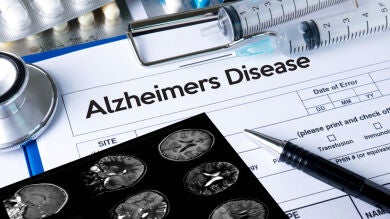 La voz y el Alzheimer: la IA podrá determinar en qué fase se encuentra la enfermedad 