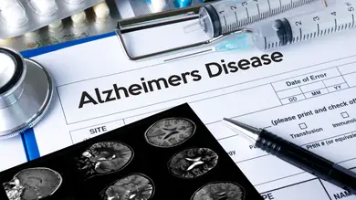 La voz y el Alzheimer: la IA podrá determinar en qué fase se encuentra la enfermedad 