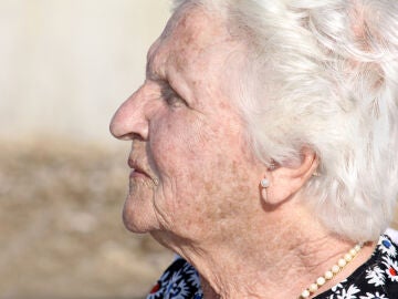 Persona mayor con manchas en la piel