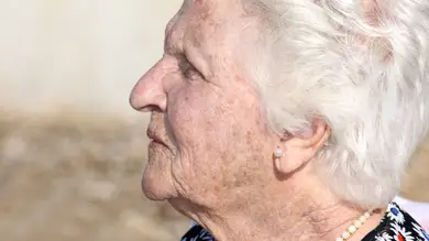 Qué es la hiperpigmentación y por qué afecta más a los mayores de 60