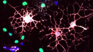 Confirman que las células del sistema inmune regeneran menos mielina con el envejecimiento