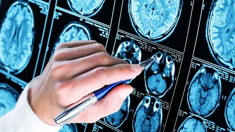 Distintas zonas de un cerebro Distintas zonas de un cerebro