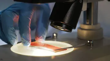Científico médico estudia muestra de sangre bajo el microscopio