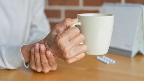 Manos temblorosas por el Parkinson Manos temblorosas por el Parkinson