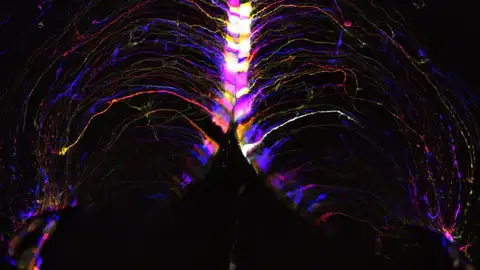 En la imágen, células cerebrales, llamadas tanicitos, iluminadas y codificadas por colores En la imágen, células cerebrales, llamadas tanicitos, iluminadas y codificadas por colores