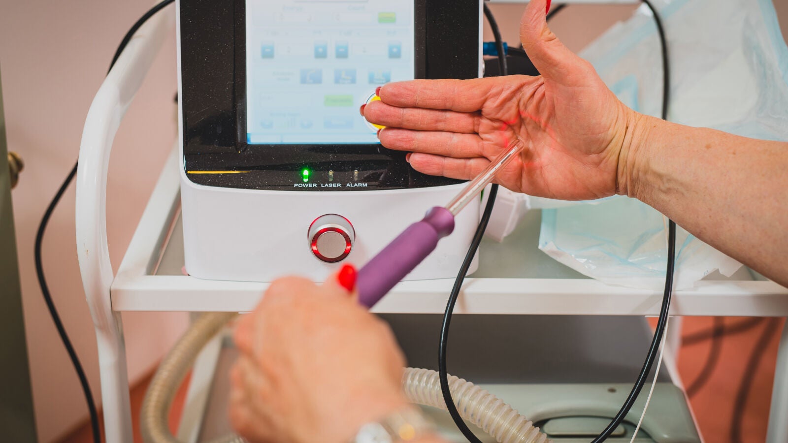 El láser vaginal mejora la calidad de vida de la mujer en la menopausia