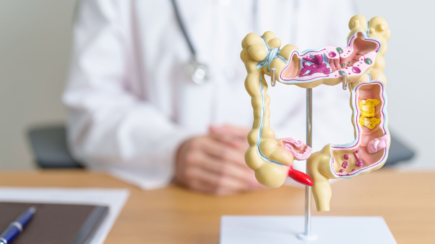 Maqueta de un colon