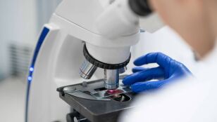 La falta de una prote&iacute;na inicia el c&aacute;ncer de colon en ratones