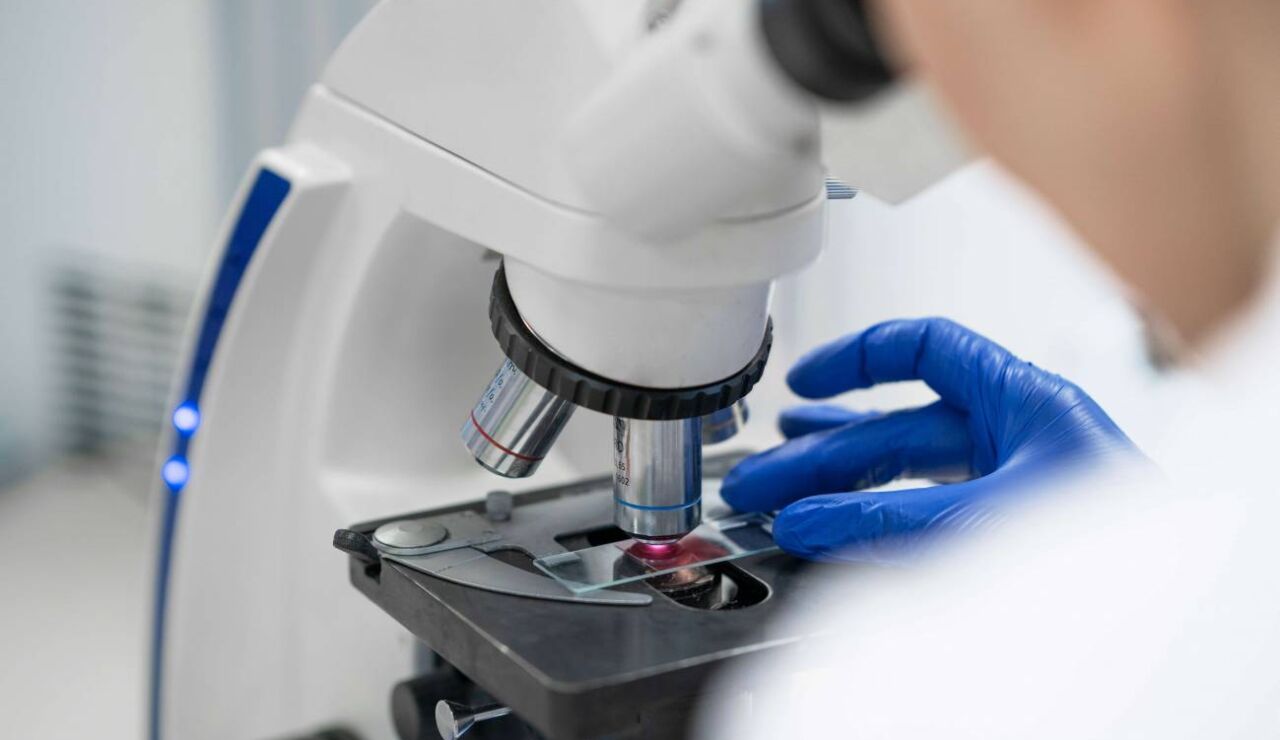 La falta de una prote&iacute;na inicia el c&aacute;ncer de colon en ratones