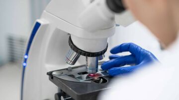 La falta de una prote&iacute;na inicia el c&aacute;ncer de colon en ratones