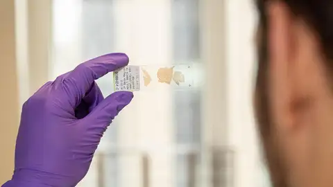 Investigador examina un portaobjetos de vidrio que contiene una lámina finísima del cerebro de un superanciano Investigador examina un portaobjetos de vidrio que contiene una lámina finísima del cerebro de un superanciano