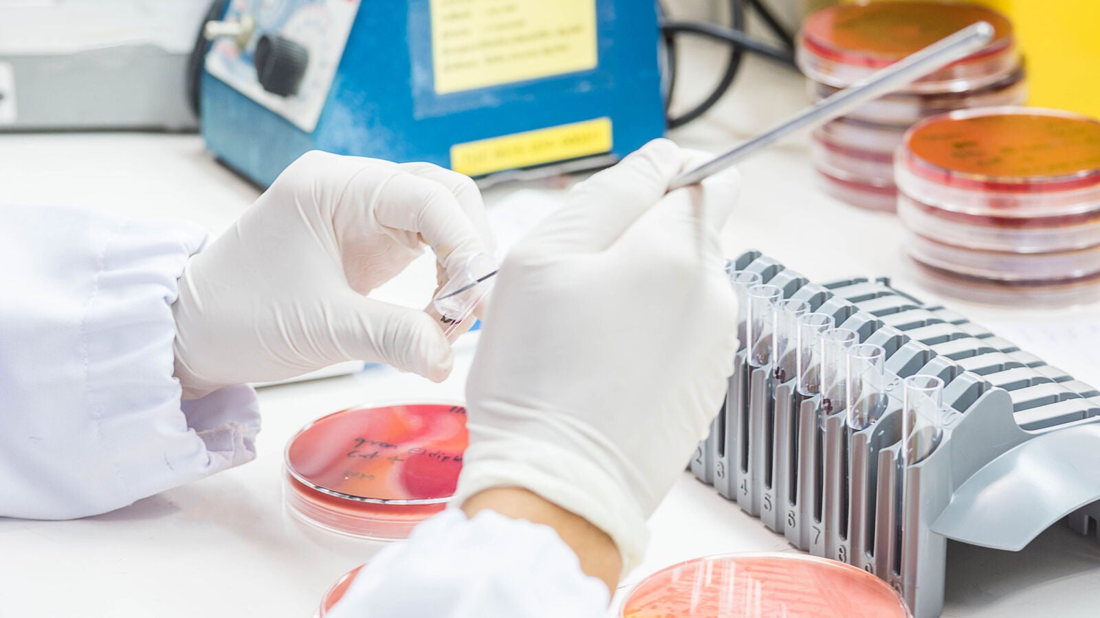 La OMS advierte de que la resistencia a los antibióticos ha aumentado en más del 40% en los últimos años