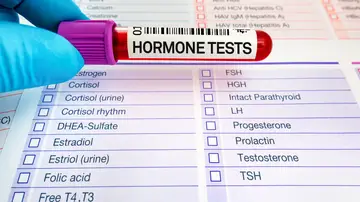 Test Hormonal Test Hormonal