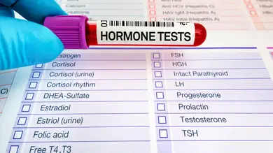 Una hormona podría relacionarse con mayor mortalidad en cáncer de mama posmenopáusico en mujeres con obesidad Una hormona podría relacionarse con mayor mortalidad en cáncer de mama posmenopáusico en mujeres con obesidad