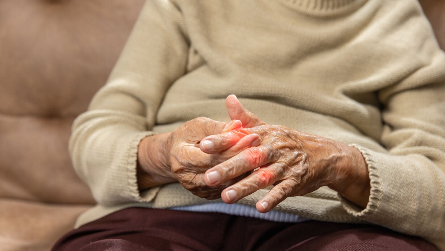 Dolor articular en manos