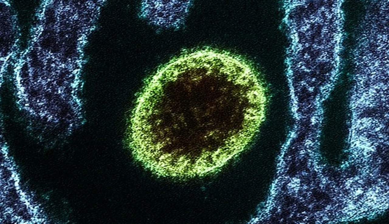 Virus Nipah