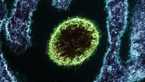 Virus Nipah Virus Nipah