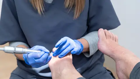 Persona mayor en el podólogo Persona mayor en el podólogo