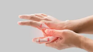 Manos con artrosis Manos con artrosis