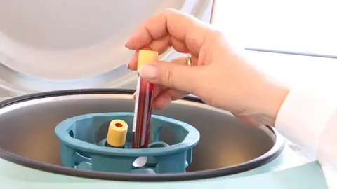 Análisis de sangre Análisis de sangre