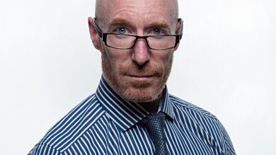 Descubren una interacción entre genes que aumenta el riesgo de alopecia