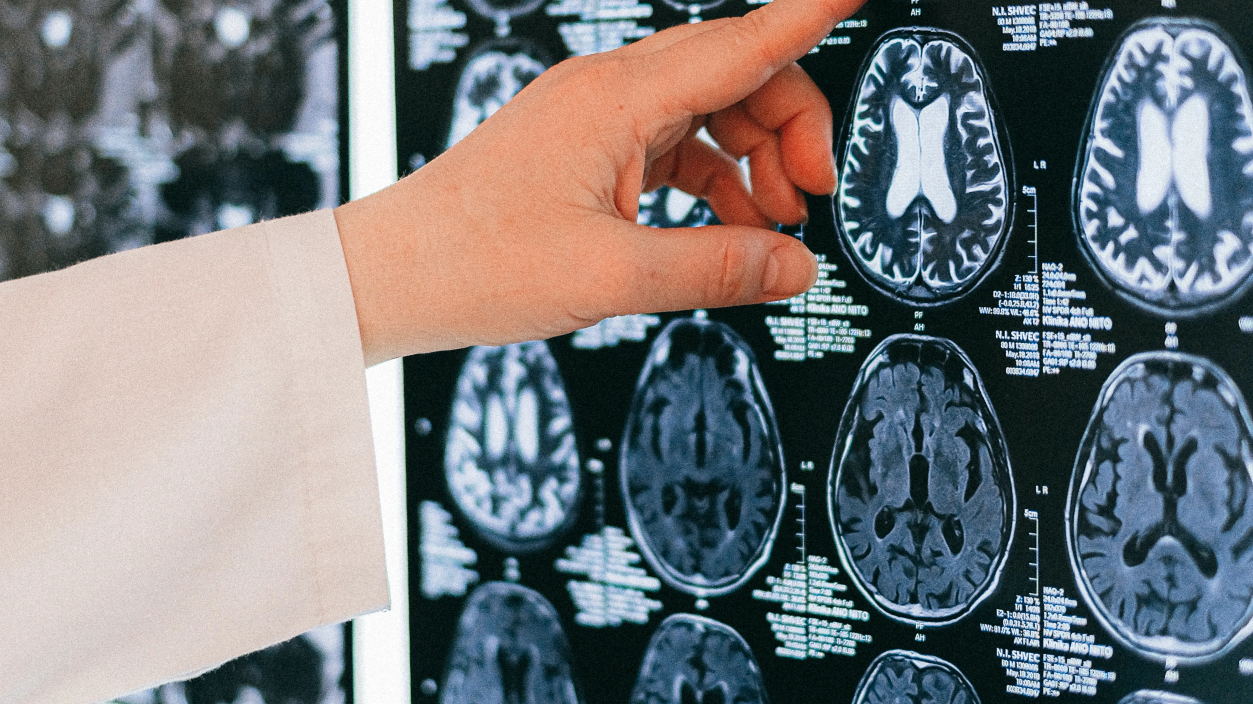 INVESTIGACIONES CEREBRALES