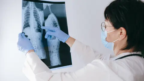 Avances para el desarrollo de nuevas pruebas en la detección temprana del cáncer Médico señala prueba diagnóstica