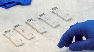 La OMS advierte sobre una nueva variante de Covid bajo vigilancia ante el aumento mundial de casos