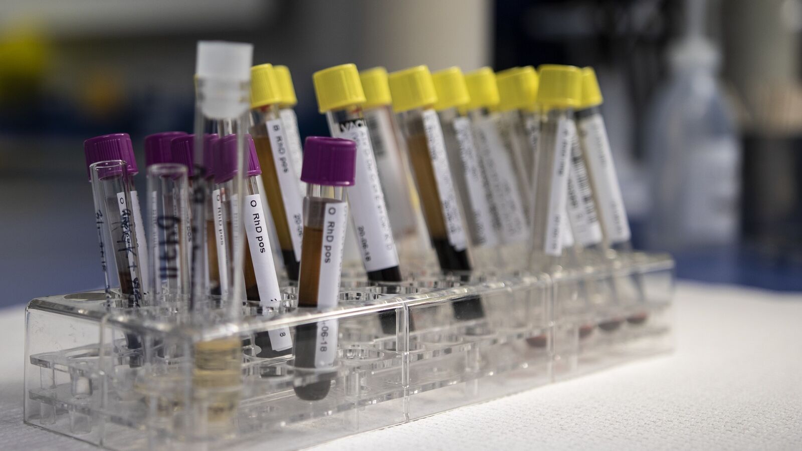 Revelan la eficacia de una prueba de sangre para detectar el cáncer de colon