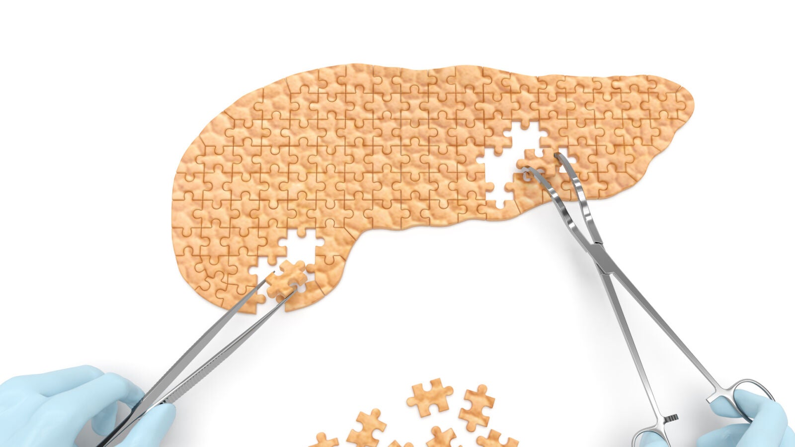 Nueva combinación de inmunoterapia, posible tratamiento del cáncer de páncreas