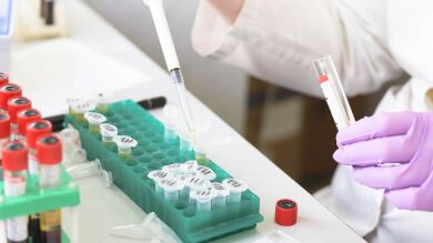 Un grupo de cinentíficos españoles encuentran una nueva técnica para tratar el Parkinson