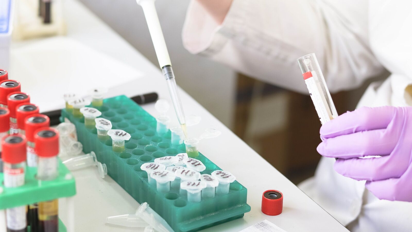 Un grupo de cinentíficos españoles encuentran una nueva técnica para tratar el Parkinson