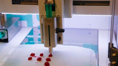 Una combinación de fármacos mejora supervivencia en cáncer de colon agresivo