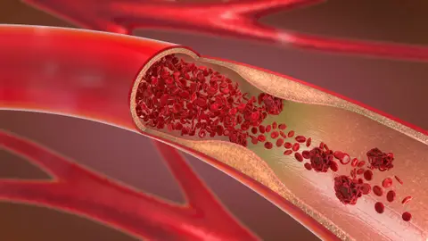 Arterias Arterias