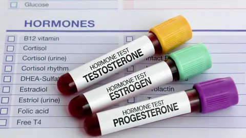 Testo hormonal Testo hormonal