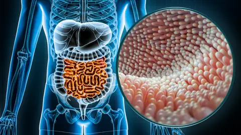 Intestinos Intestinos
