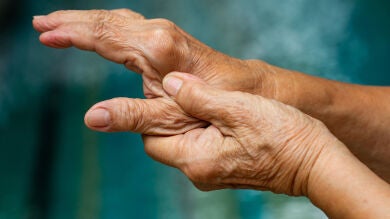 Medidas para luchar contra la artrosis y el envejecimiento