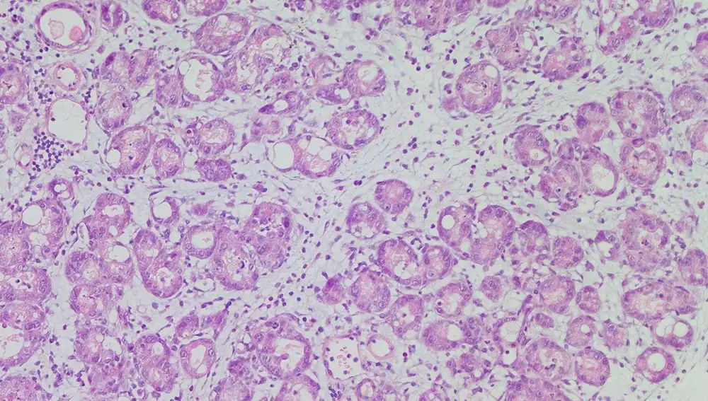 Células del páncreas