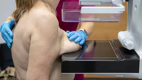 Una mujer haciéndose una mamografía Una mujer haciéndose una mamografía