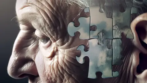 Alzheimer Alzheimer