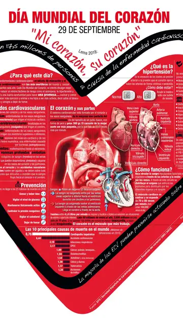 Archivo de la infografía de la Agencia EFE Archivo de la infografía de la Agencia EFE