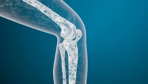 Una nueva técnica podrá prevenir las fracturas por osteoporosis en personas mayores