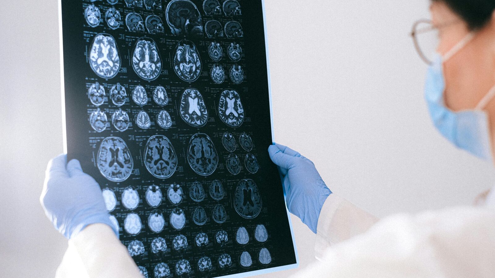  Estos son algunos síntomas clave para detectar el deterioro cognitivo