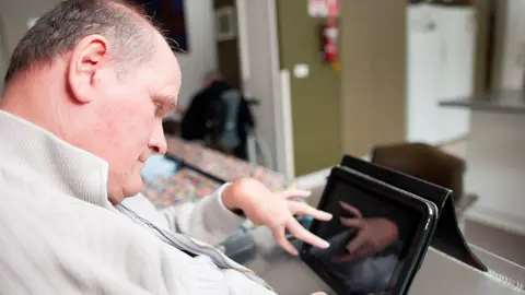 Hombre mayor con parálisis cerebral Hombre mayor con parálisis cerebral