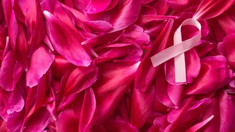Cáncer de mama Cáncer de mama