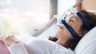 Mujer tratando su apnea del sue&ntilde;o